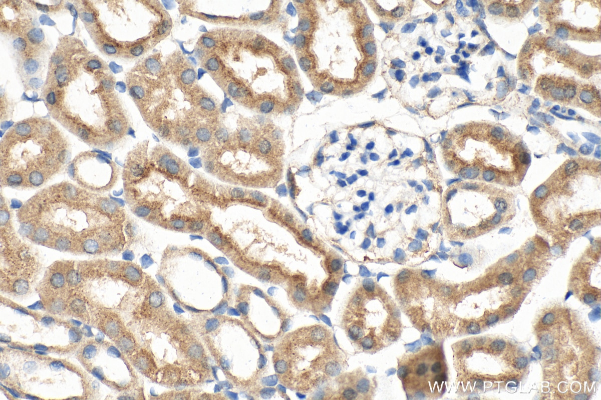 Immunohistochemistry (IHC) staining of mouse kidney tissue using ATP5A1 Polyclonal antibody (14676-1-AP)