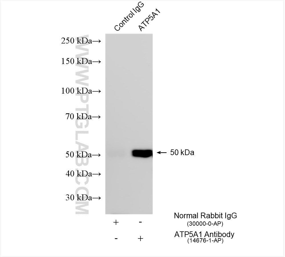 Immunoprecipitation (IP) experiment of HeLa cells using ATP5A1 Polyclonal antibody (14676-1-AP)