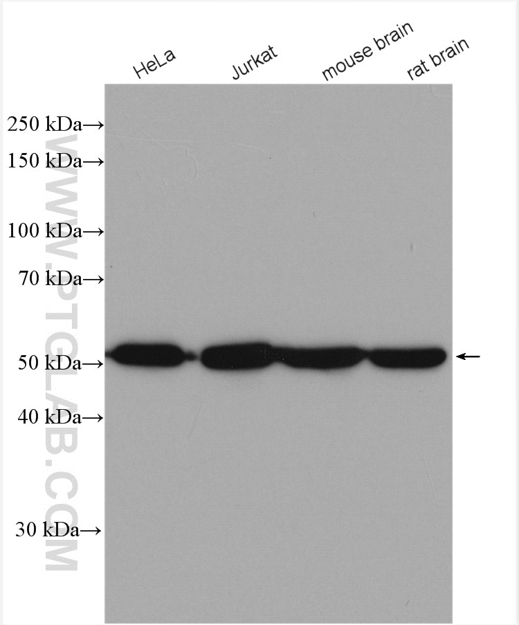 Western Blot (WB) analysis of various lysates using ATP5A1 Polyclonal antibody (14676-1-AP)