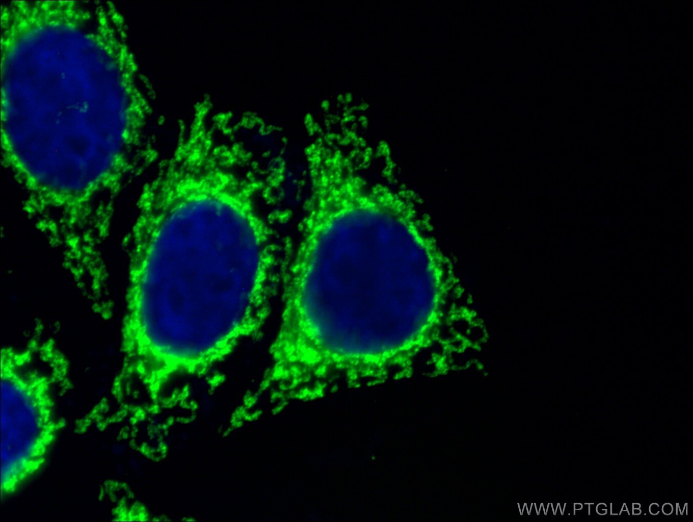 IF Staining of HeLa using 66037-1-Ig