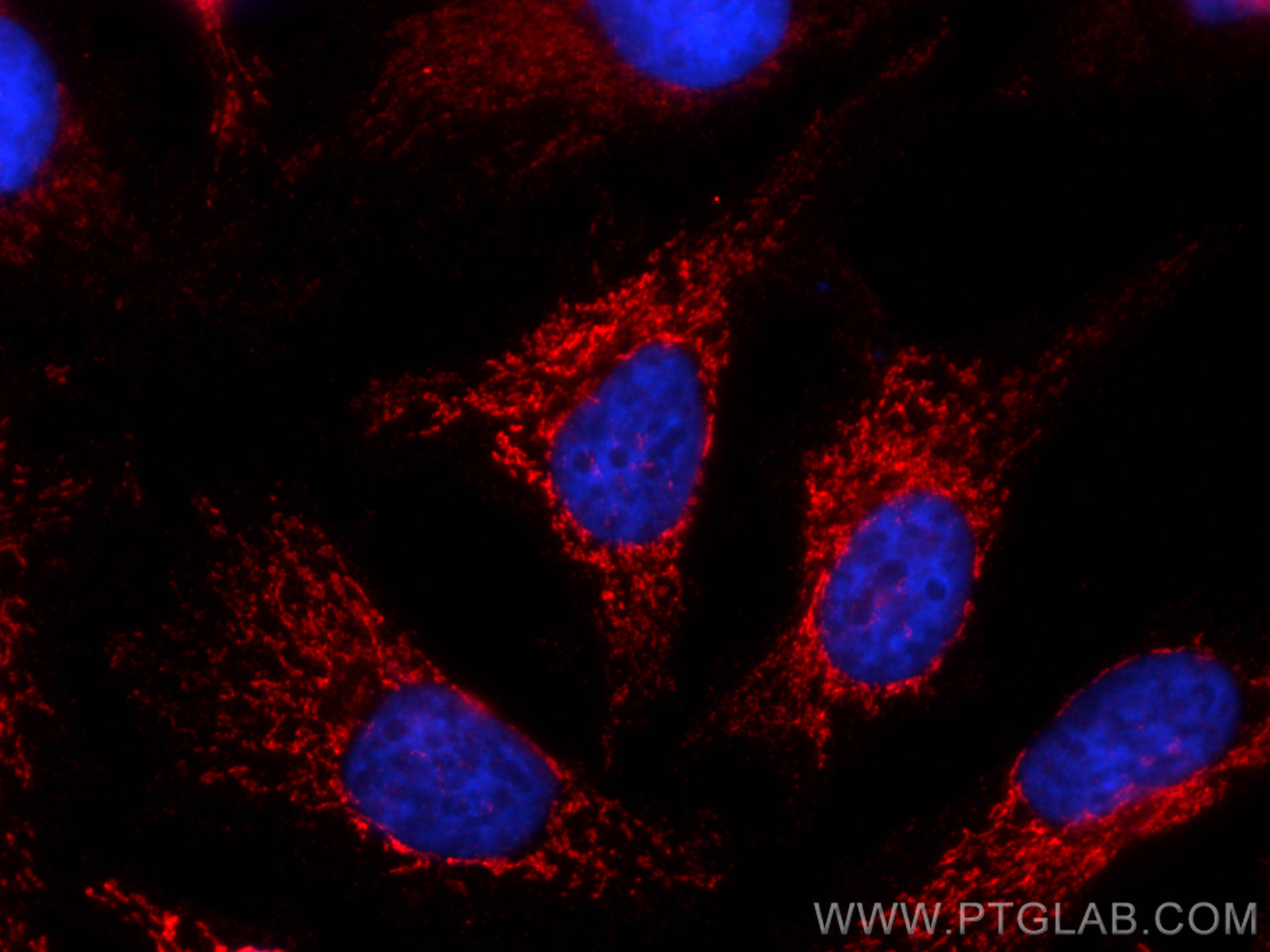 Immunofluorescence (IF) / fluorescent staining of HeLa cells using ATP5A1 Monoclonal antibody (66037-1-Ig)