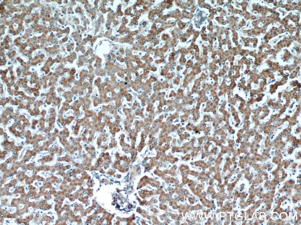 Immunohistochemistry (IHC) staining of human liver tissue using ATP5A1 Monoclonal antibody (66037-1-Ig)