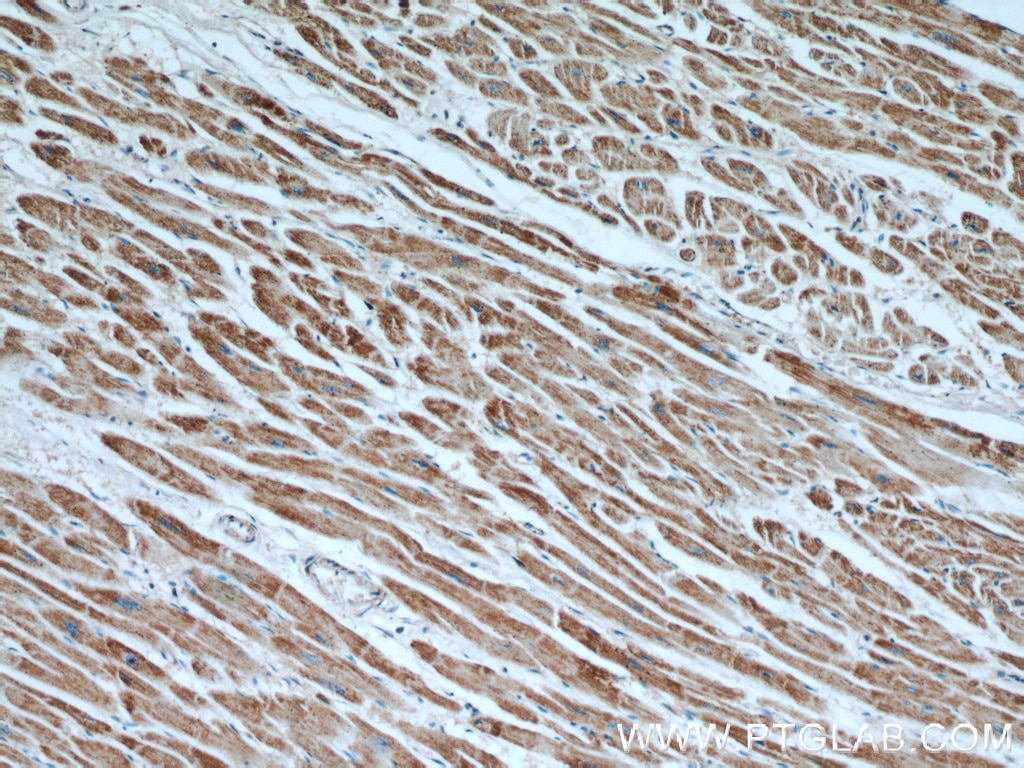 Immunohistochemistry (IHC) staining of human heart tissue using ATP5A1 Monoclonal antibody (66037-1-Ig)