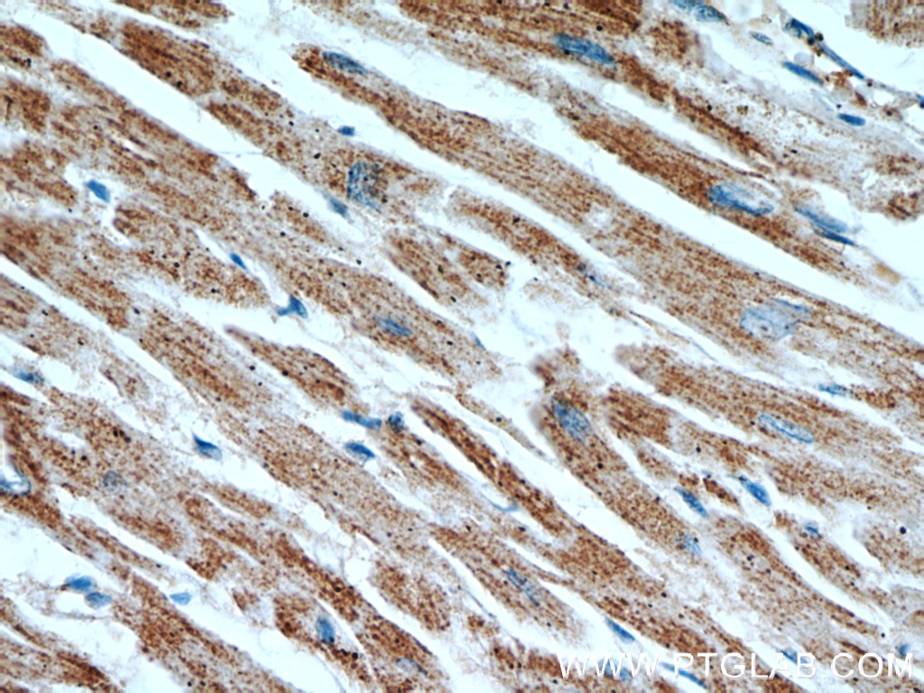 Immunohistochemistry (IHC) staining of human heart tissue using ATP5A1 Monoclonal antibody (66037-1-Ig)