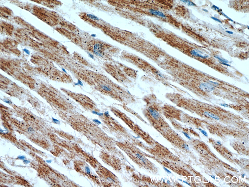 IHC staining of human heart using 66037-1-Ig