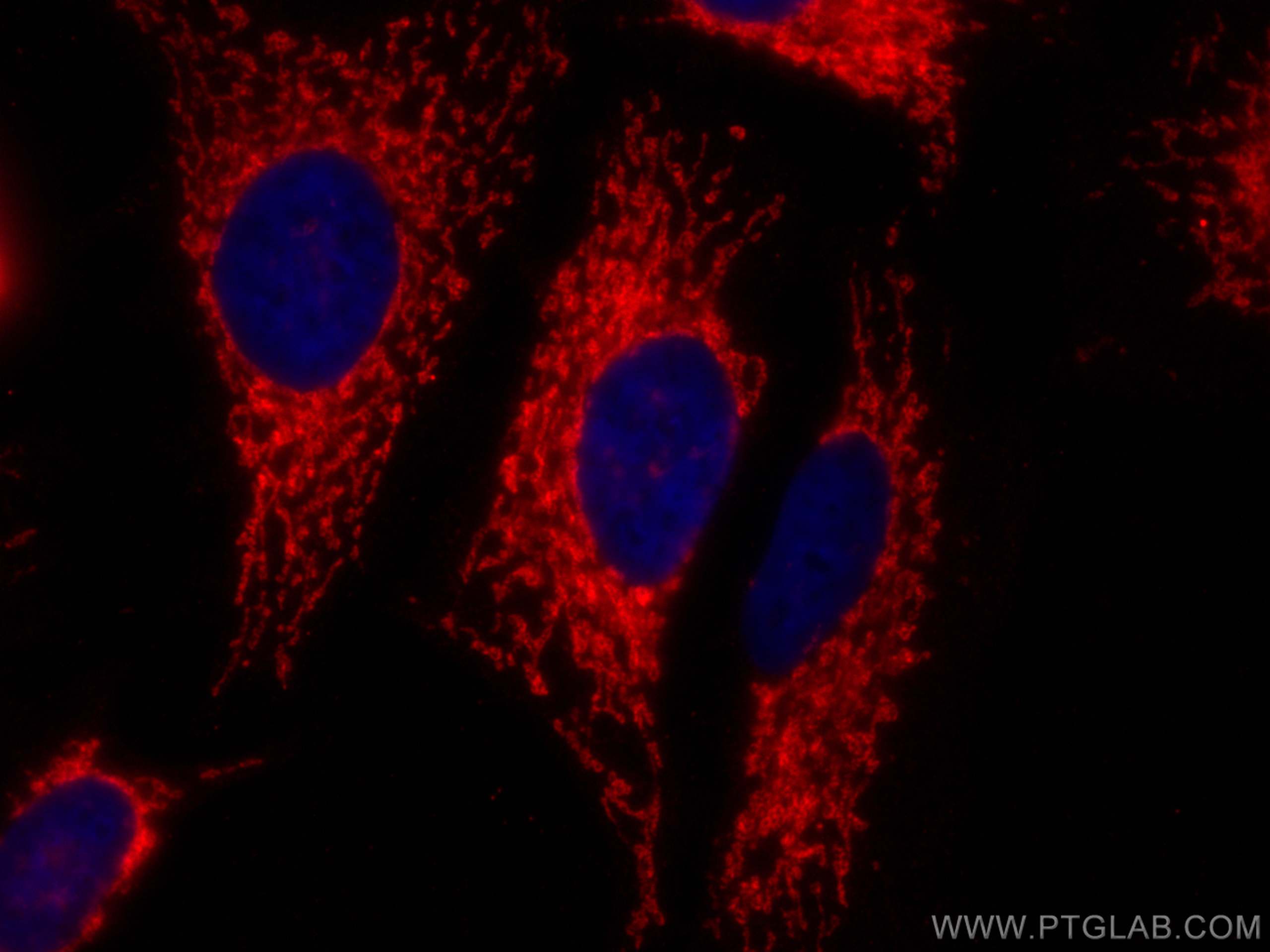 Immunofluorescence (IF) / fluorescent staining of HeLa cells using ATP5A1 Recombinant antibody (82288-1-RR)