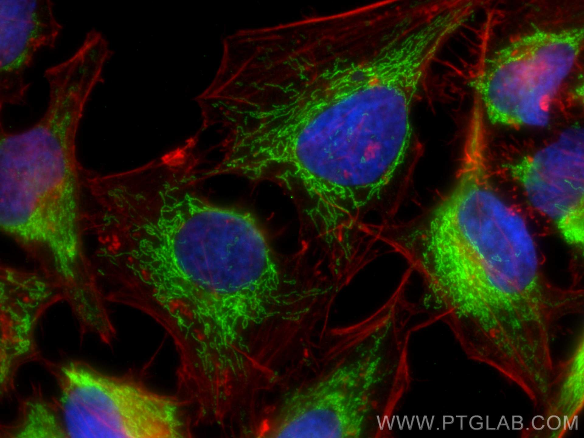 Immunofluorescence (IF) / fluorescent staining of HeLa cells using ATP5A1 Recombinant antibody (82288-1-RR)