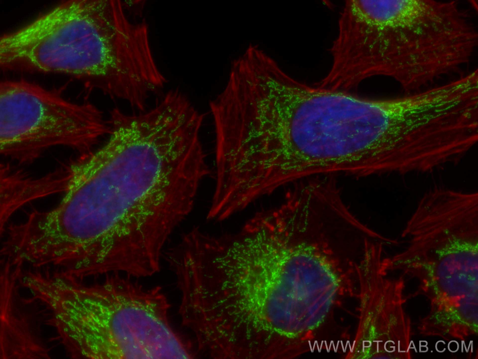 Immunofluorescence (IF) / fluorescent staining of HeLa cells using ATP5A1 Recombinant antibody (82288-1-RR)