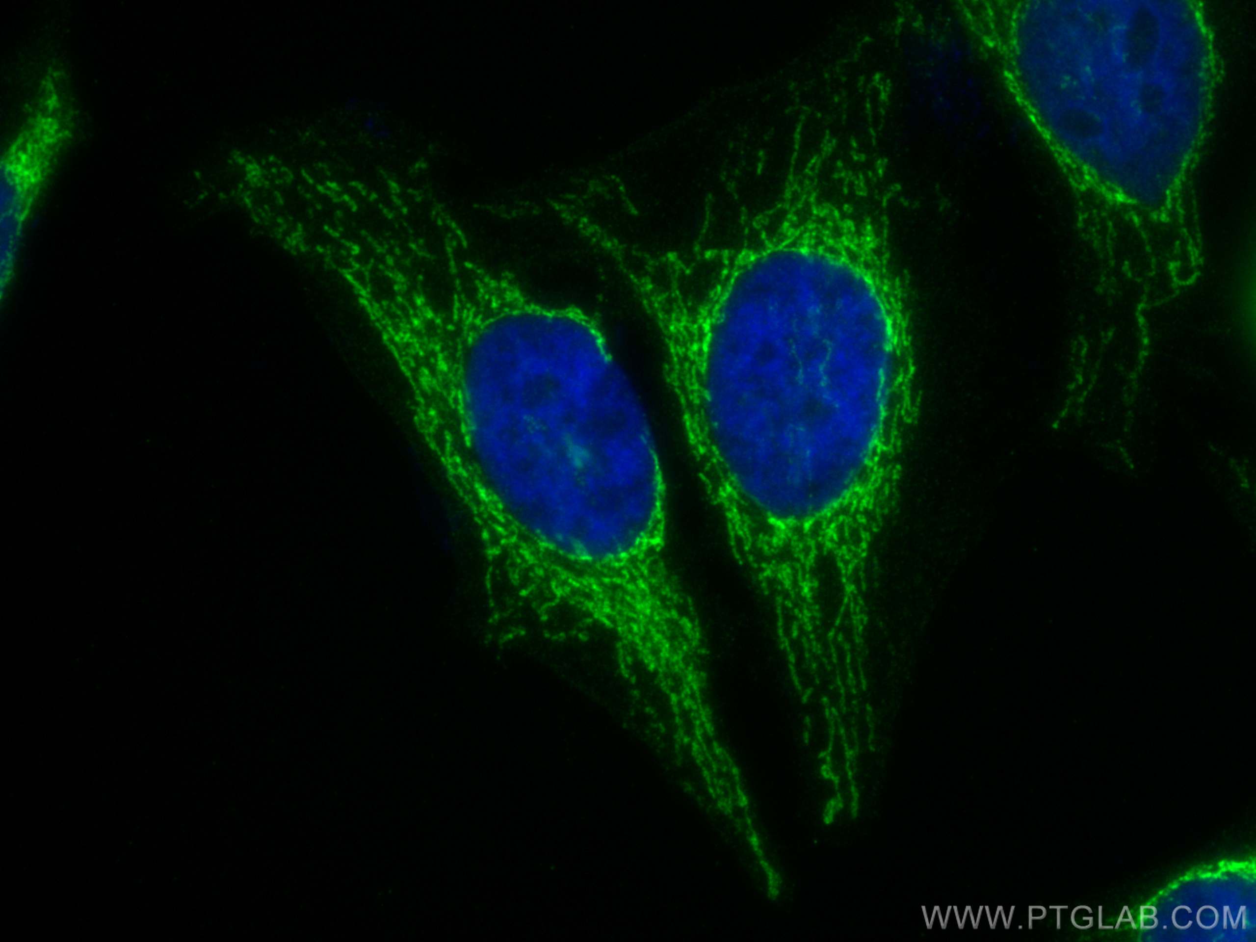 IF Staining of HeLa using 82288-1-RR