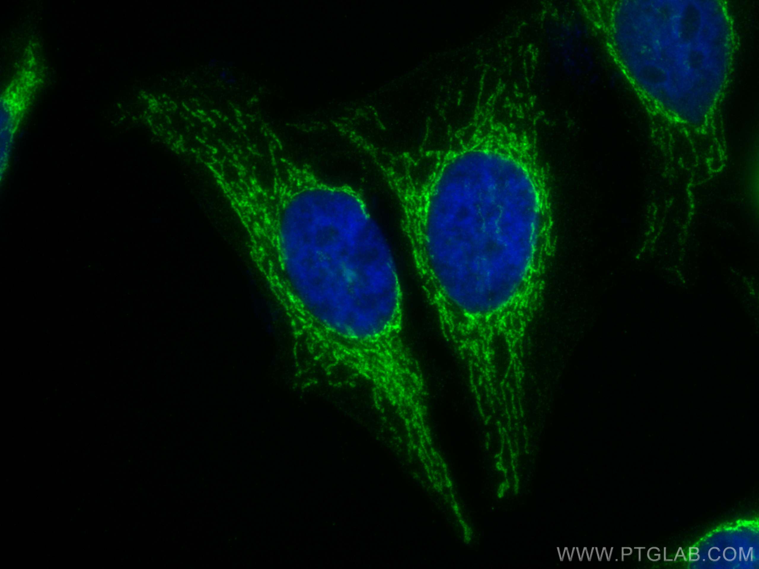 Immunofluorescence (IF) / fluorescent staining of HeLa cells using ATP5A1 Recombinant antibody (82288-1-RR)