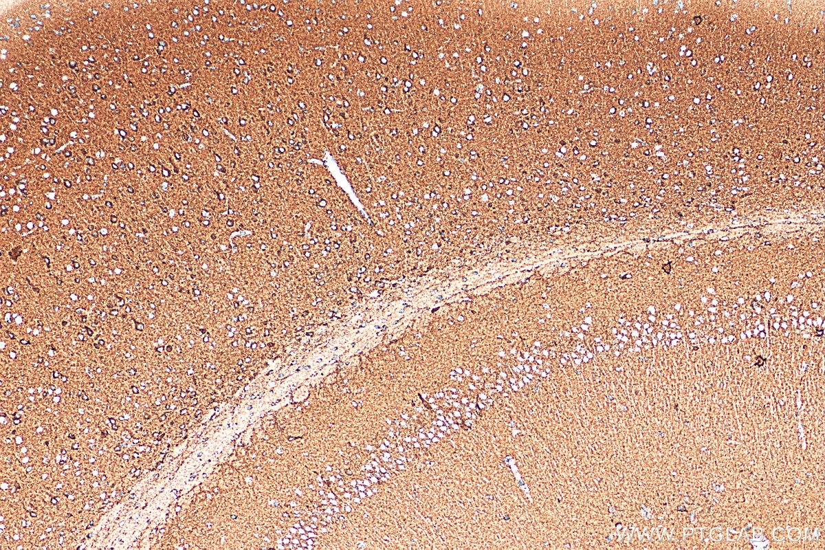 Immunohistochemistry (IHC) staining of mouse brain tissue using ATP5A1 Recombinant antibody (82288-1-RR)