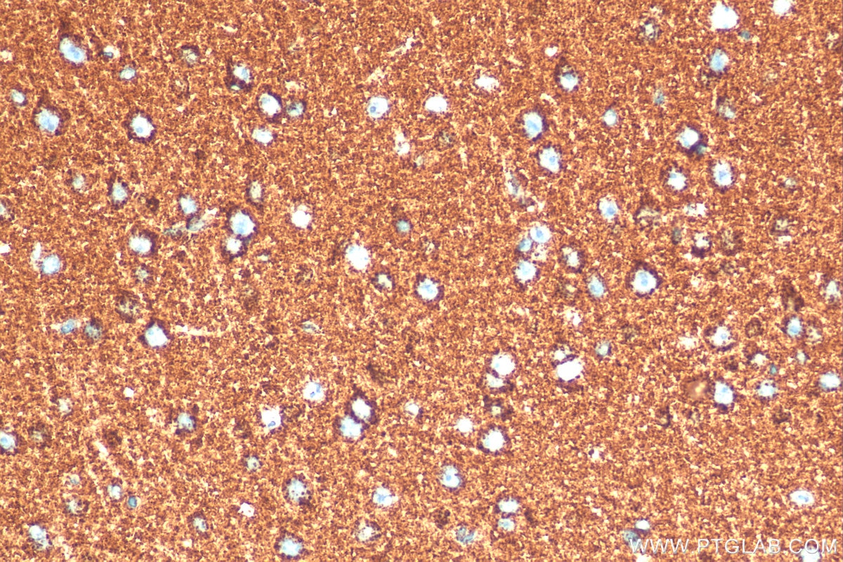 Immunohistochemistry (IHC) staining of mouse brain tissue using ATP5A1 Recombinant antibody (82288-1-RR)
