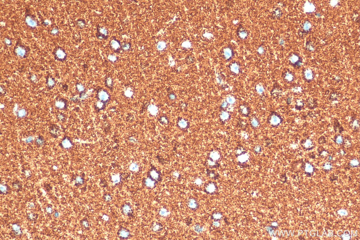 IHC staining of mouse brain using 82288-1-RR