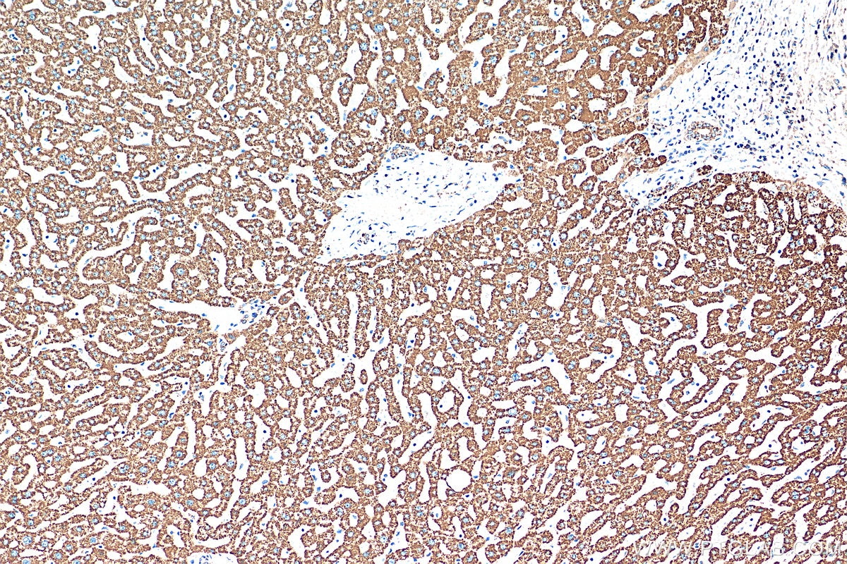 IHC staining of human liver using 82288-1-RR