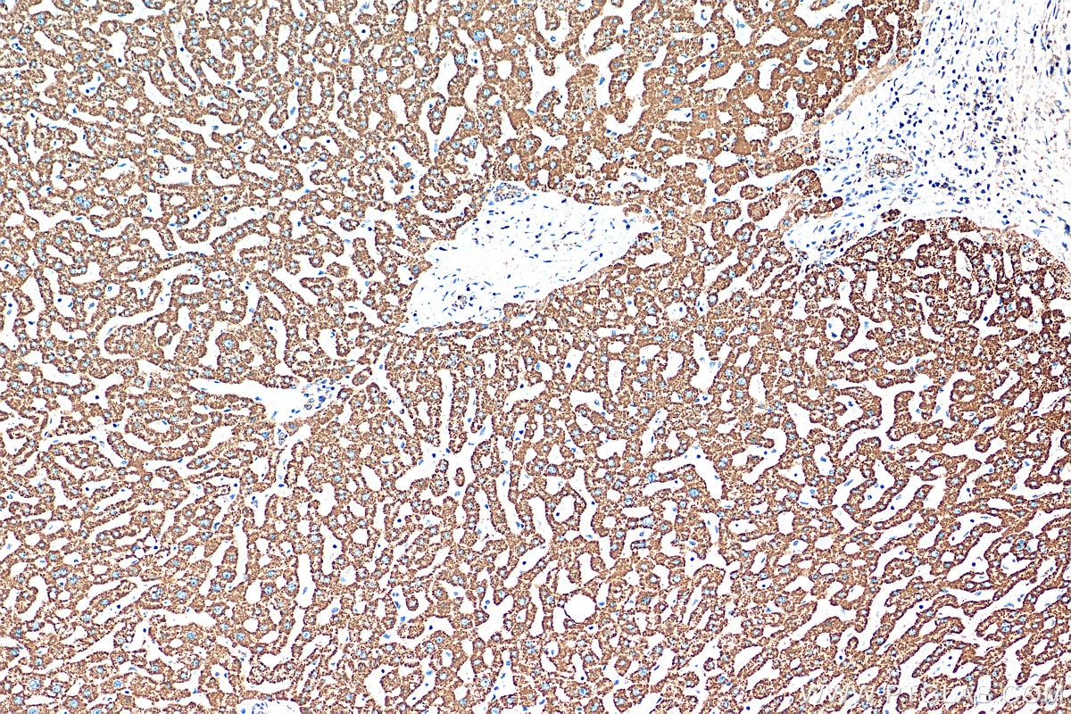 Immunohistochemistry (IHC) staining of human liver tissue using ATP5A1 Recombinant antibody (82288-1-RR)