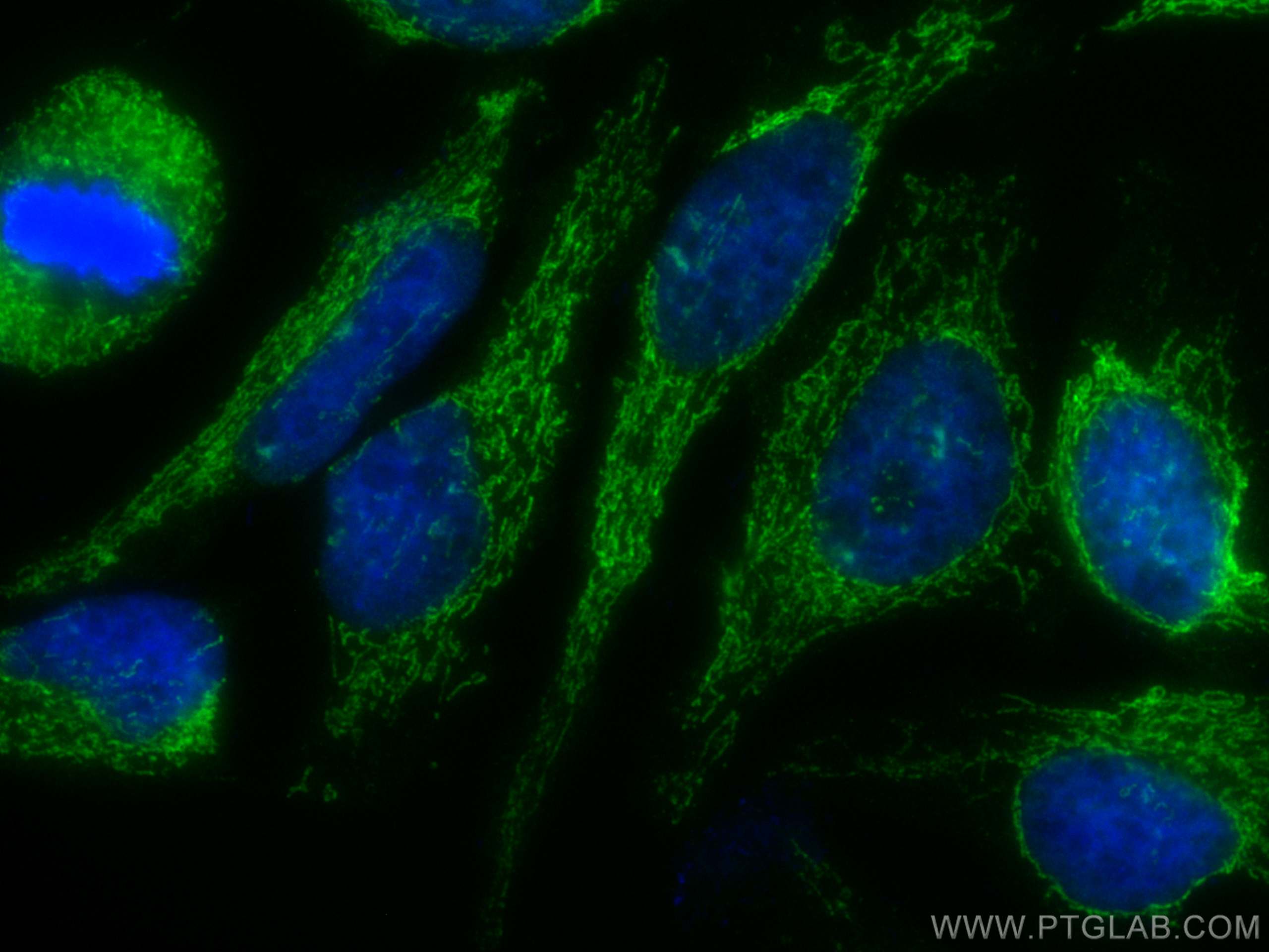 Immunofluorescence (IF) / fluorescent staining of HeLa cells using CoraLite® Plus 488-conjugated ATP5A1 Recombinant a (CL488-82288)