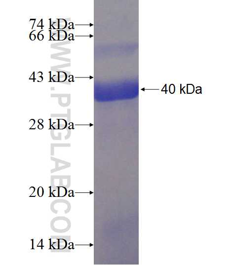 ATP5A1 fusion protein Ag8119 SDS-PAGE