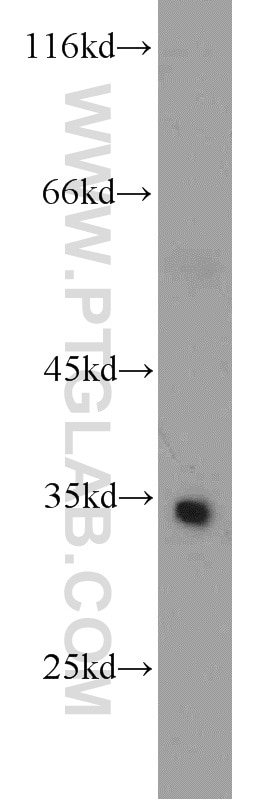 Western Blot (WB) analysis of human heart tissue using ATP5C1 Polyclonal antibody (10910-1-AP)