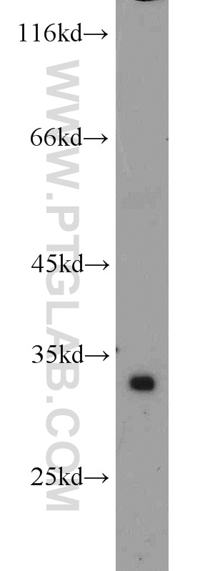 Western Blot (WB) analysis of human skeletal muscle tissue using ATP5C1 Polyclonal antibody (10910-1-AP)