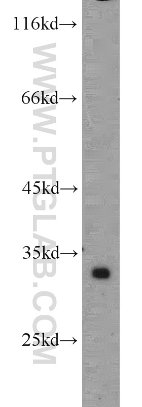 WB analysis of human skeletal muscle using 10910-1-AP