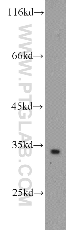 Western Blot (WB) analysis of mouse brain tissue using ATP5C1 Polyclonal antibody (10910-1-AP)