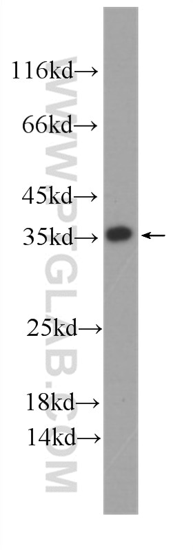 Western Blot (WB) analysis of fetal human brain tissue using ATP5C1 Monoclonal antibody (60284-1-Ig)
