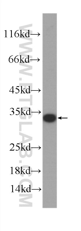 Western Blot (WB) analysis of human heart tissue using ATP5C1 Monoclonal antibody (60284-1-Ig)