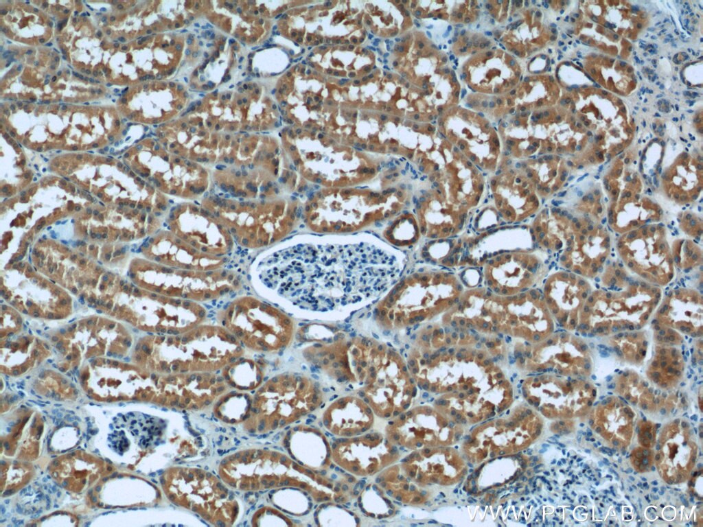 Immunohistochemistry (IHC) staining of human kidney tissue using ATP5D Polyclonal antibody (14893-1-AP)