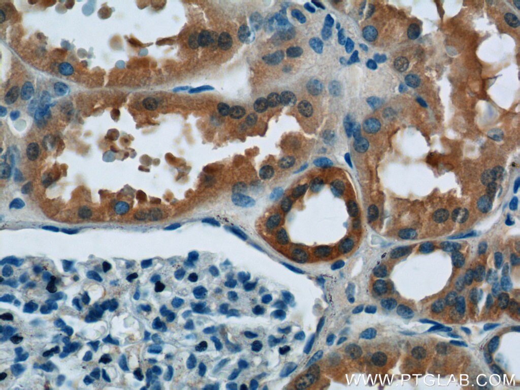 Immunohistochemistry (IHC) staining of human kidney tissue using ATP5D Polyclonal antibody (14893-1-AP)