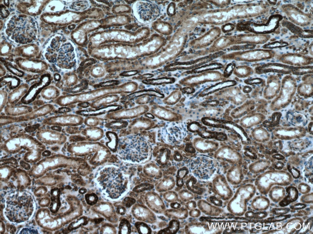 IHC staining of human kidney using 66673-1-Ig