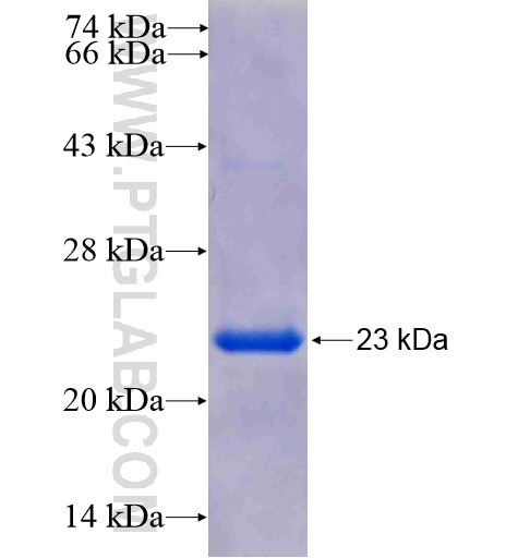 ATP5D fusion protein Ag7016 SDS-PAGE