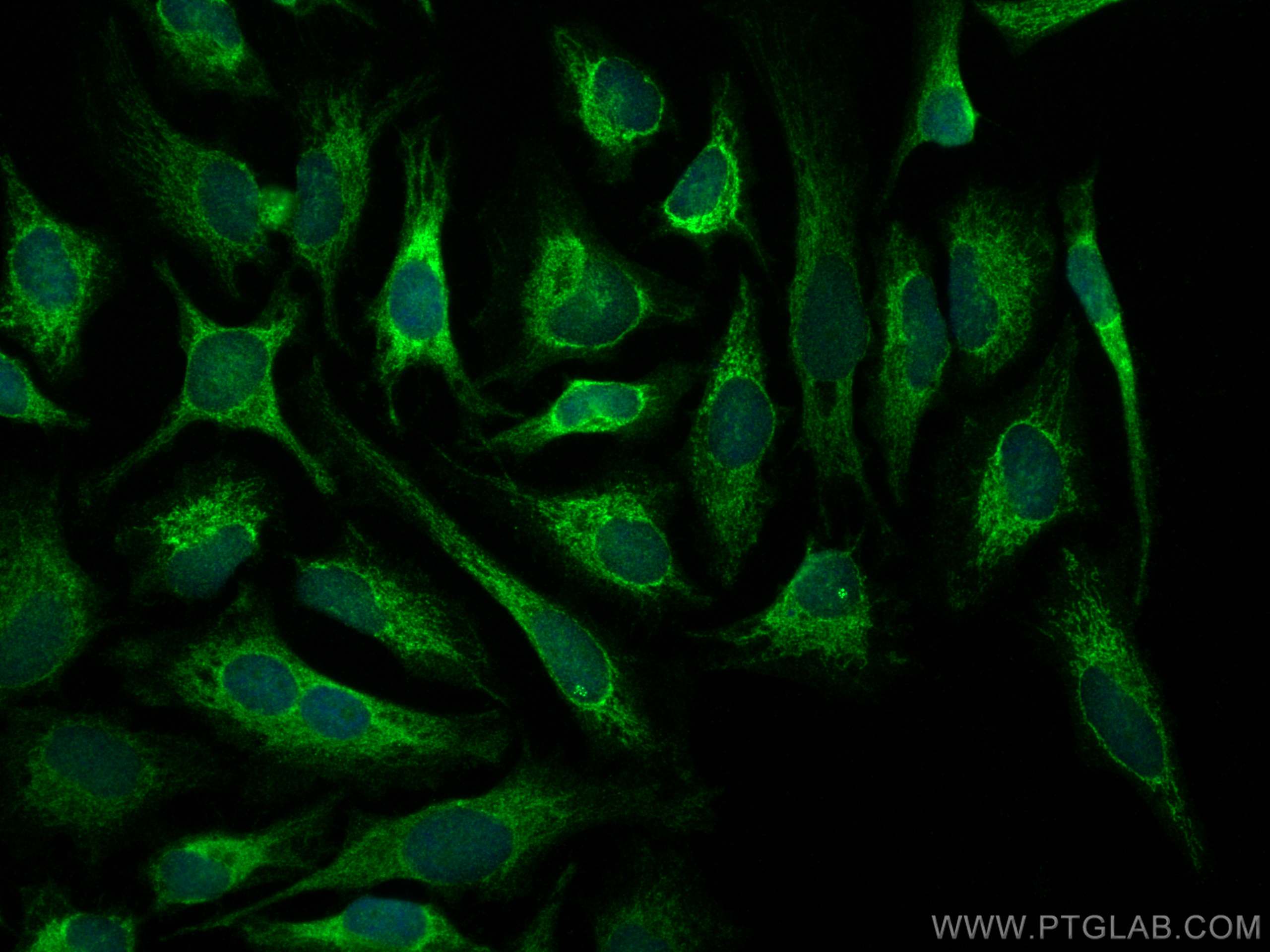 Immunofluorescence (IF) / fluorescent staining of HeLa cells using ATP5E Polyclonal antibody (15408-1-AP)