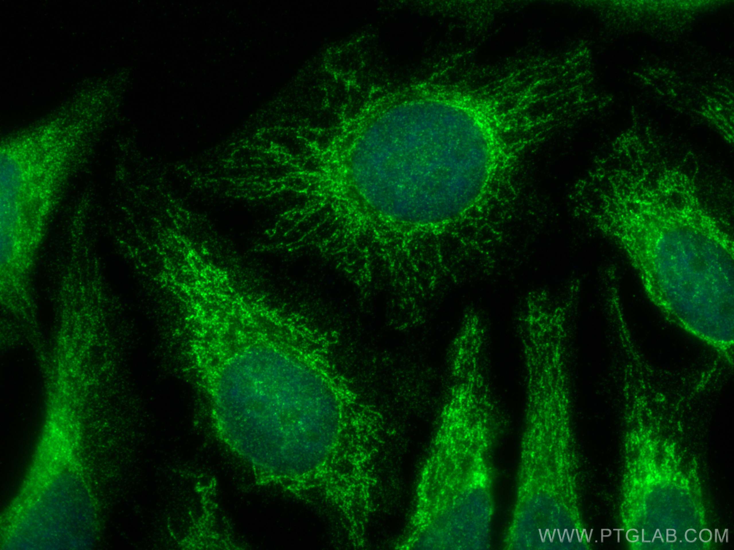 Immunofluorescence (IF) / fluorescent staining of HeLa cells using ATP5E Polyclonal antibody (15408-1-AP)