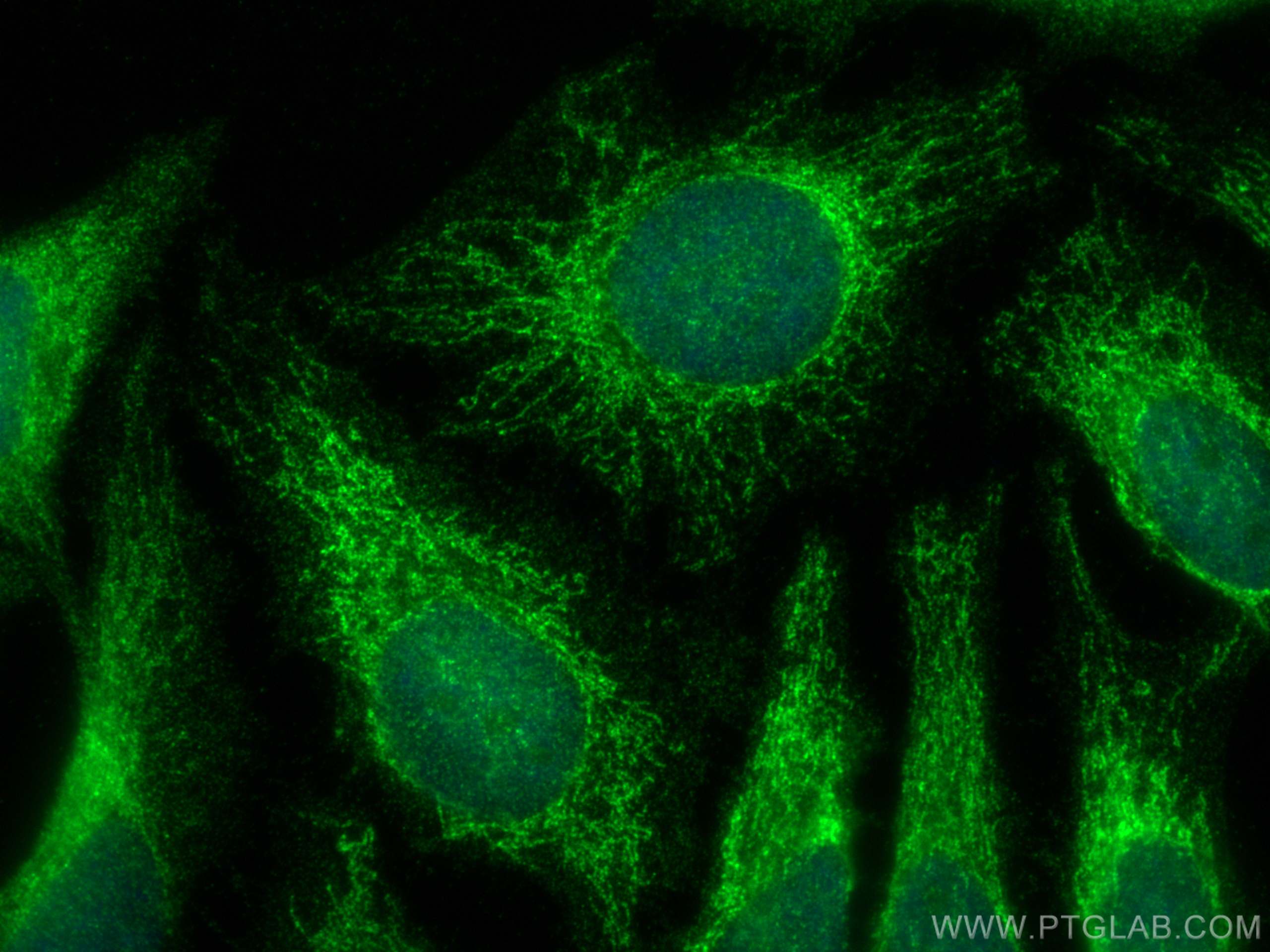 IF Staining of HeLa using 15408-1-AP