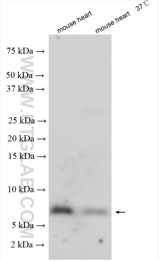 Western Blot (WB) analysis of various lysates using ATP5E Polyclonal antibody (15408-1-AP)