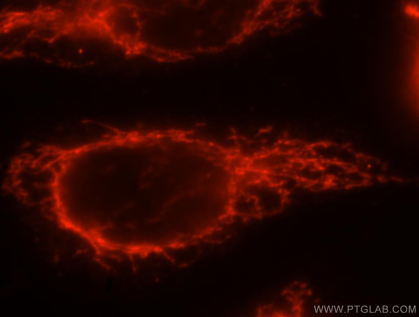 Immunofluorescence (IF) / fluorescent staining of HeLa cells using ATP5F1 Polyclonal antibody (15999-1-AP)