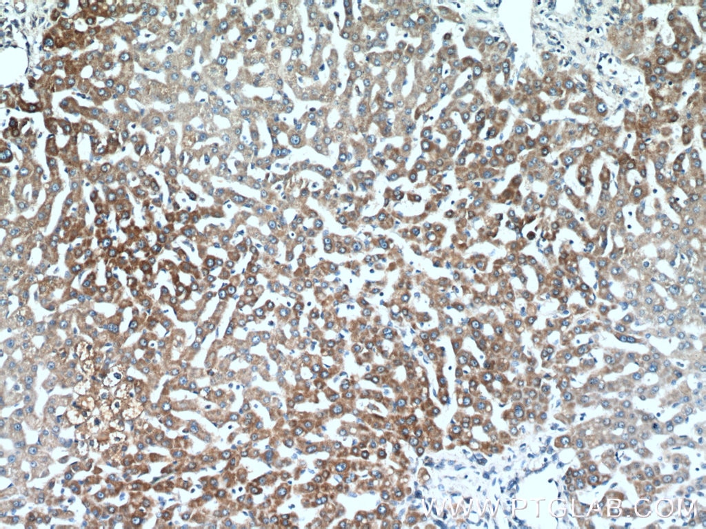 Immunohistochemistry (IHC) staining of human liver tissue using ATP5F1 Polyclonal antibody (15999-1-AP)