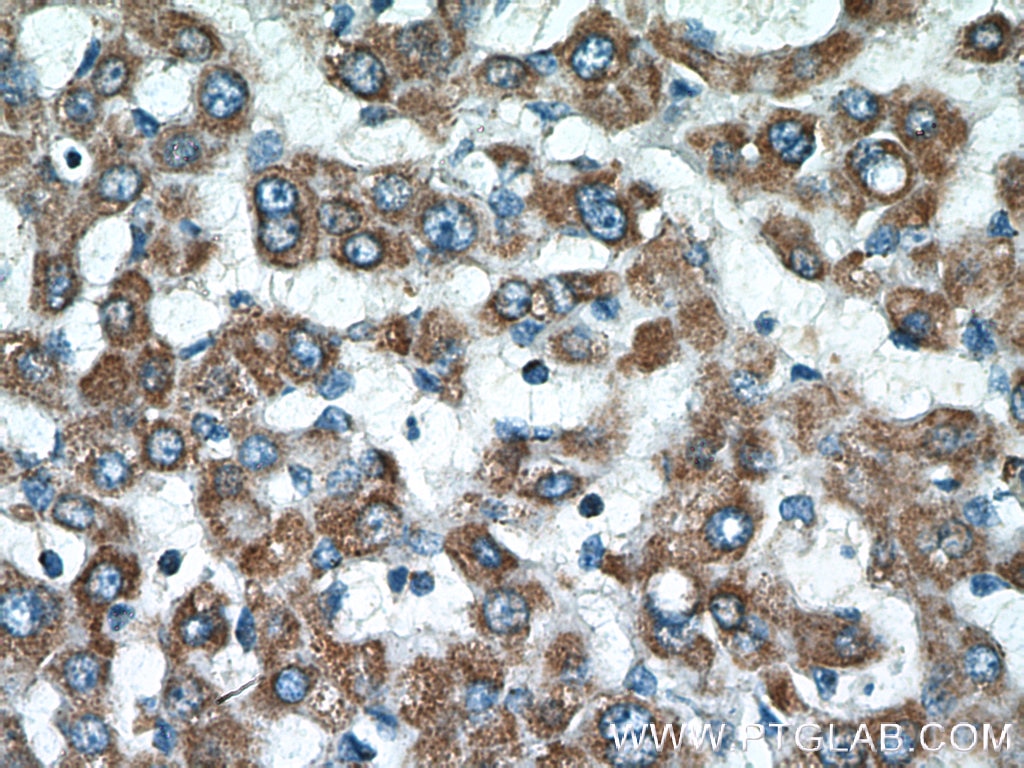 IHC staining of human liver using 15999-1-AP
