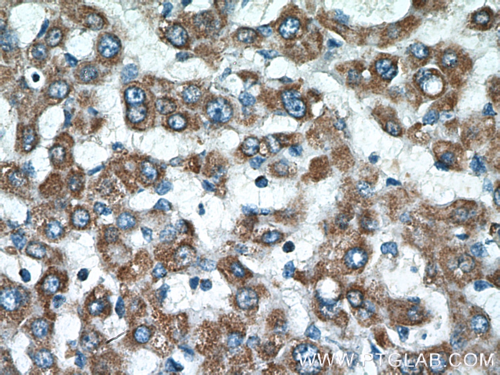 Immunohistochemistry (IHC) staining of human liver tissue using ATP5F1 Polyclonal antibody (15999-1-AP)