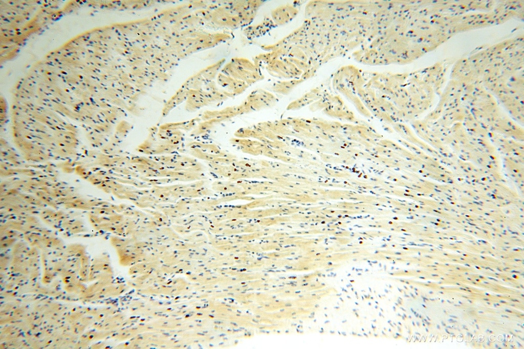 IHC staining of human heart using 15999-1-AP