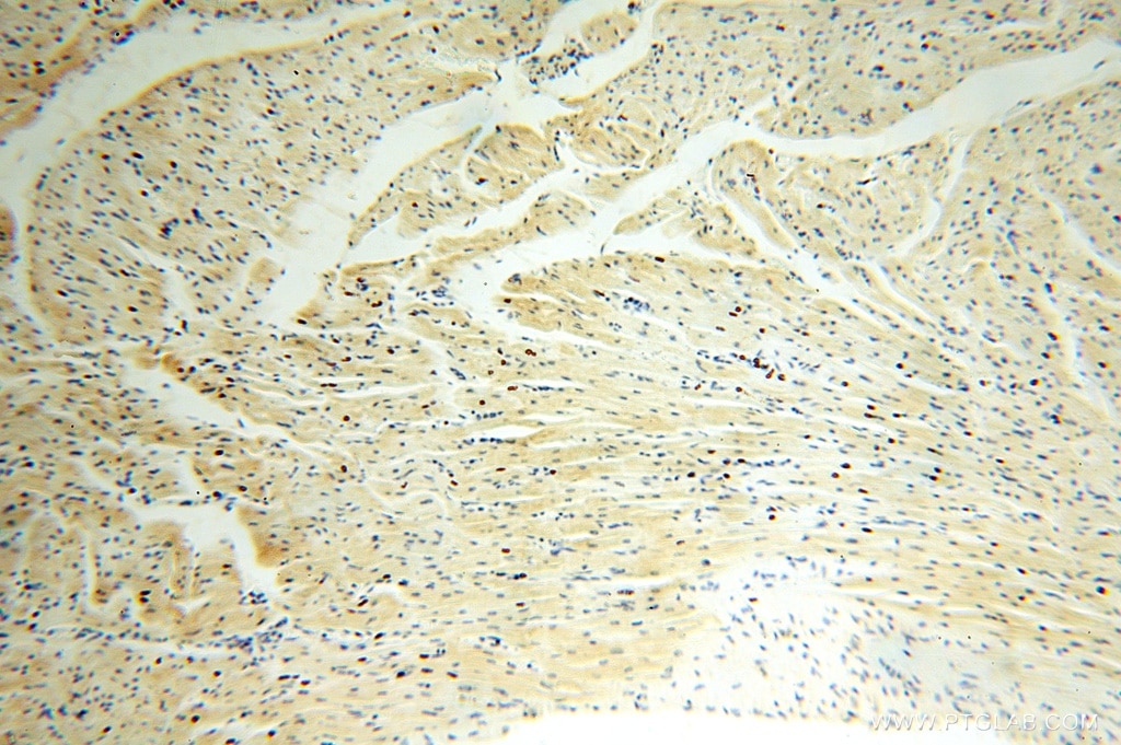 Immunohistochemistry (IHC) staining of human heart tissue using ATP5F1 Polyclonal antibody (15999-1-AP)