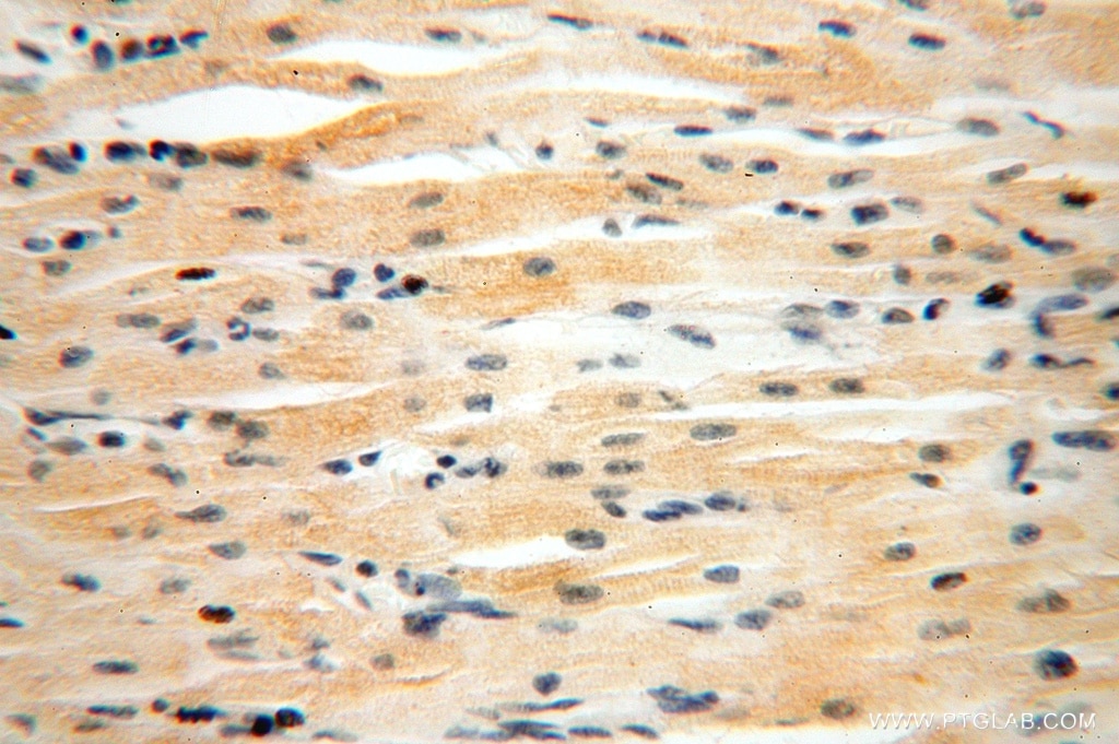 Immunohistochemistry (IHC) staining of human heart tissue using ATP5F1 Polyclonal antibody (15999-1-AP)