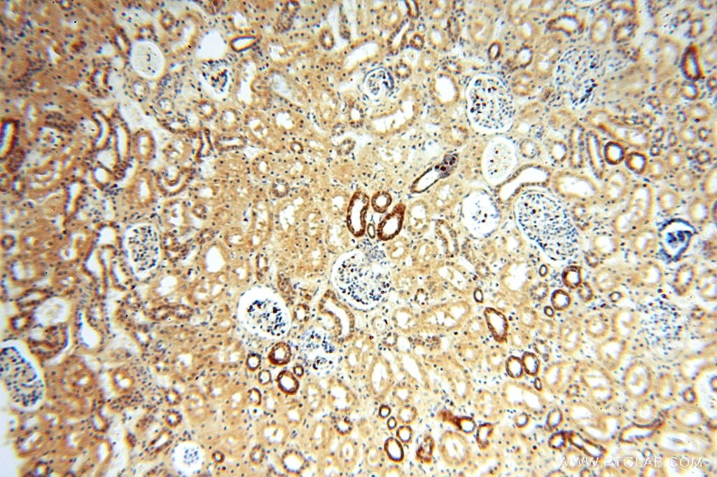 Immunohistochemistry (IHC) staining of human kidney tissue using ATP5F1 Polyclonal antibody (15999-1-AP)