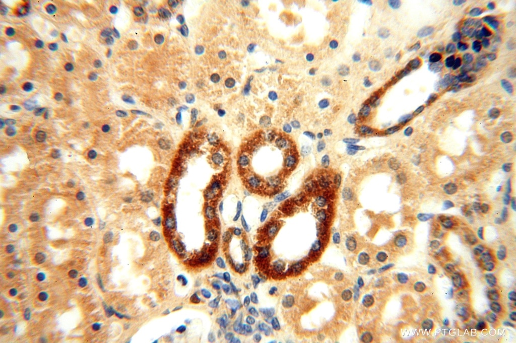 Immunohistochemistry (IHC) staining of human kidney tissue using ATP5F1 Polyclonal antibody (15999-1-AP)