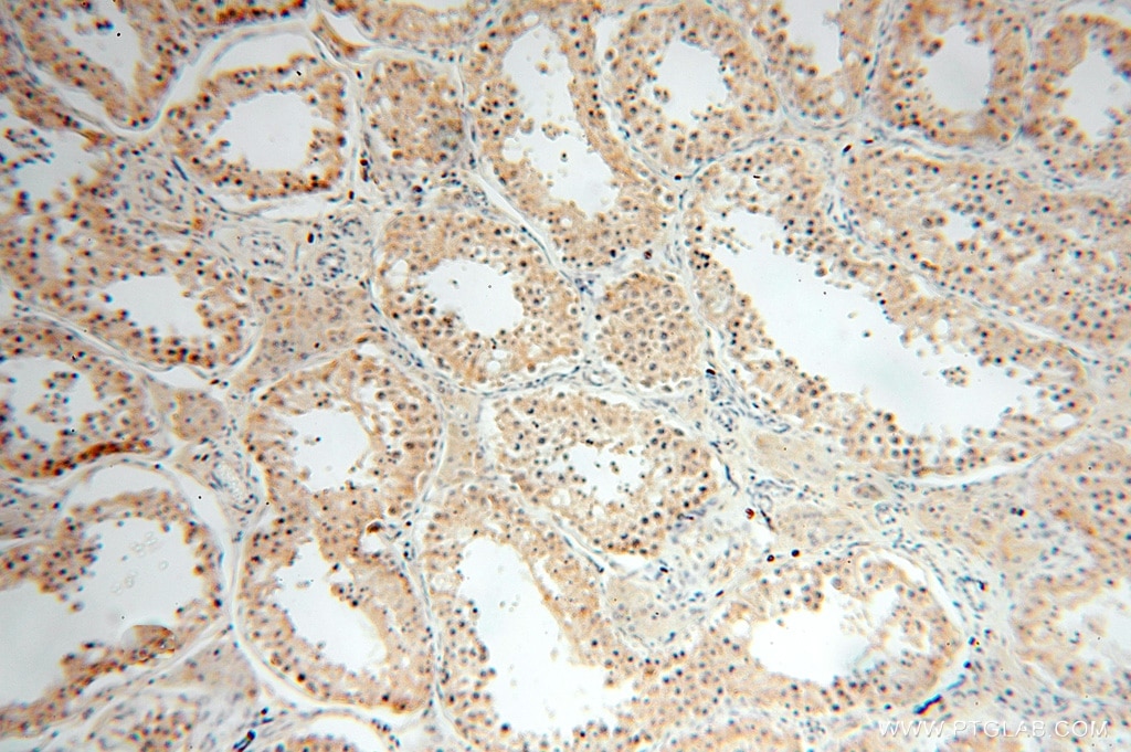 IHC staining of human testis using 15999-1-AP