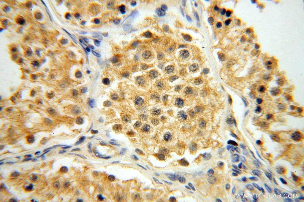 Immunohistochemistry (IHC) staining of human testis tissue using ATP5F1 Polyclonal antibody (15999-1-AP)