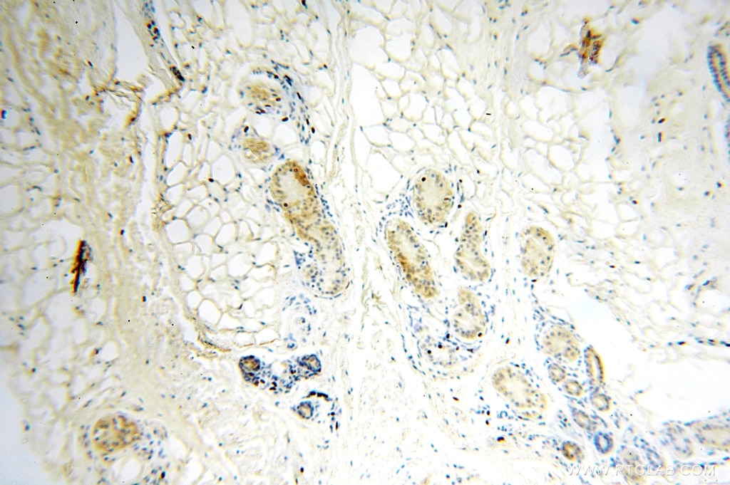 Immunohistochemistry (IHC) staining of human skin tissue using ATP5F1 Polyclonal antibody (15999-1-AP)