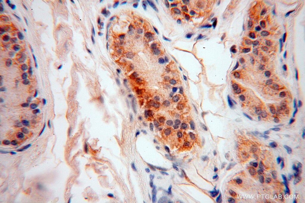 Immunohistochemistry (IHC) staining of human skin tissue using ATP5F1 Polyclonal antibody (15999-1-AP)