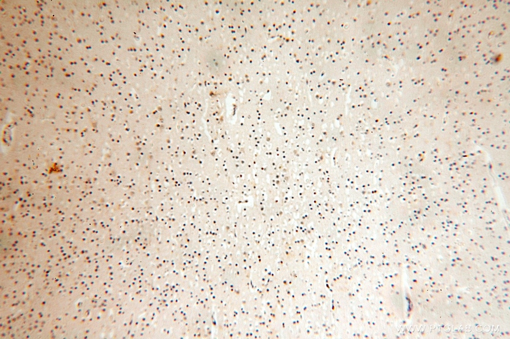 Immunohistochemistry (IHC) staining of human brain tissue using ATP5F1 Polyclonal antibody (15999-1-AP)