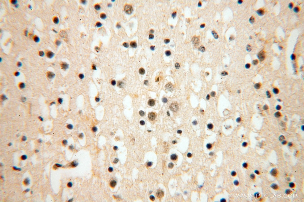 Immunohistochemistry (IHC) staining of human brain tissue using ATP5F1 Polyclonal antibody (15999-1-AP)